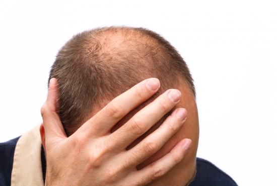 hair regrow on bald head